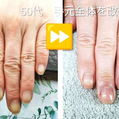 手肌のビフォーアフター